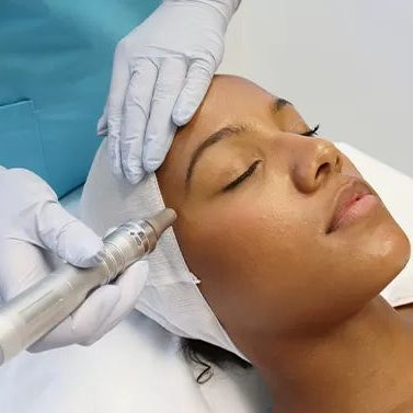B-Tox Glow Microneedling Treatment