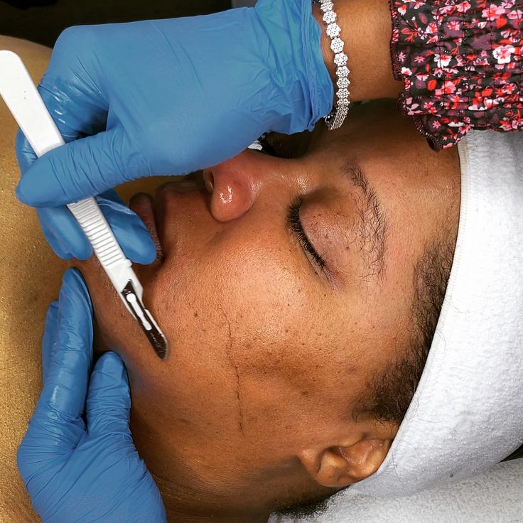 Exfoliating Dermaplaning Treatment
