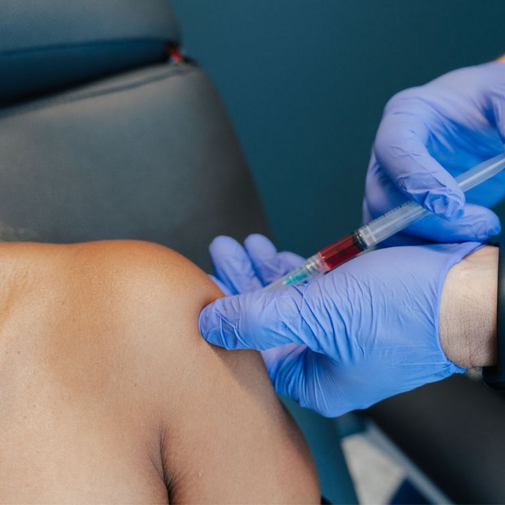 Vitamin D injection being administered in the upper arm by a licensed professional to support skin health and overall wellness.