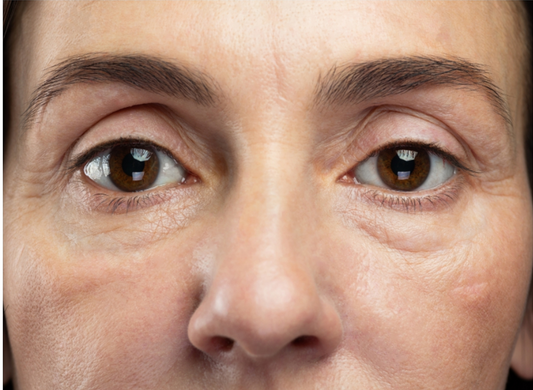 Under-Eye Care That Heals and Inspires Confidence