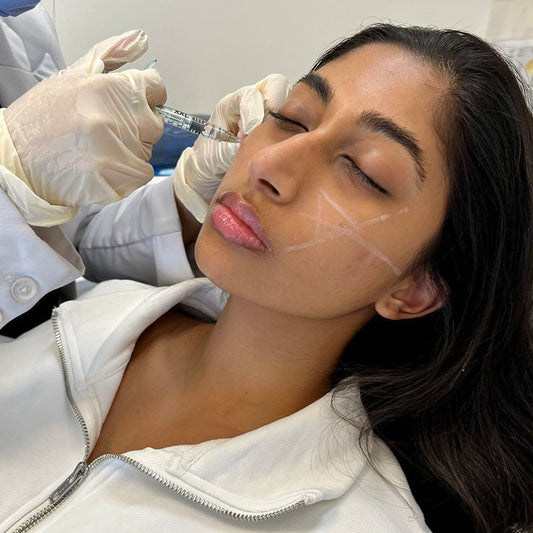 Dermal Filler Treatment 