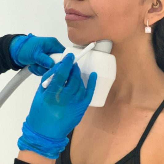 Non-surgical double chin fat dissolving treatment for a slimmer, contoured jawline