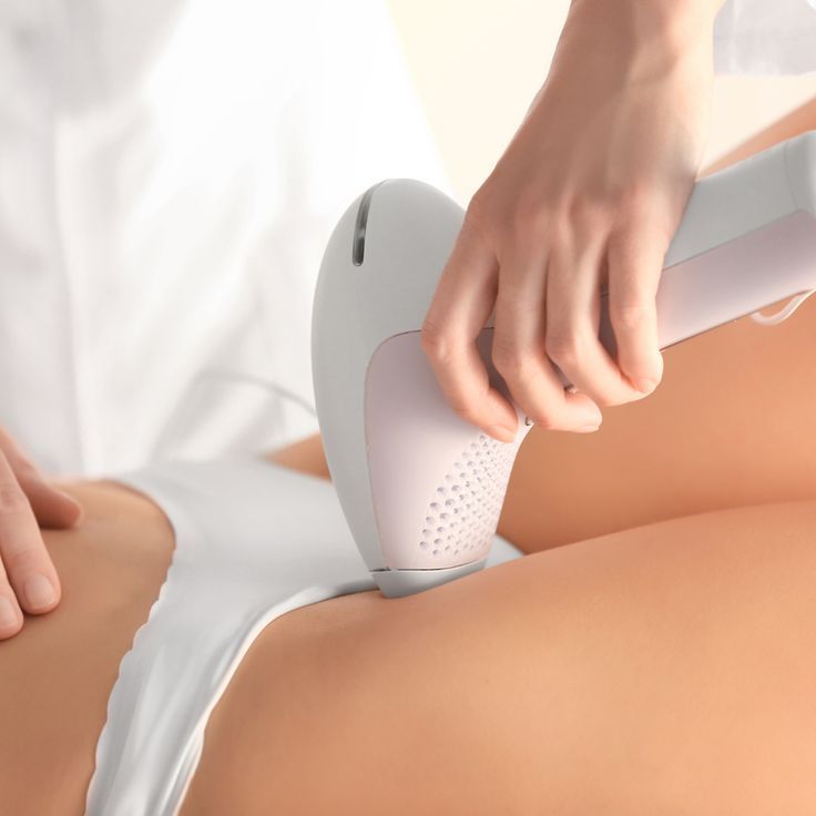 Bikini laser hair removal treatment for smooth, hair-free skin in the bikini area with permanent results